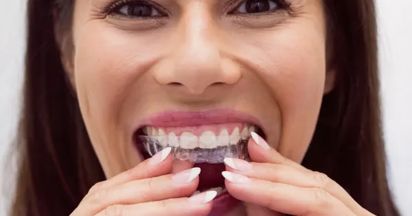 Como Usar o Clareador Dental com Segurança e Eficiência?