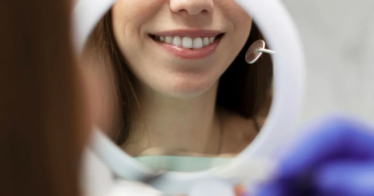 Resultados do clareamento: Quanto tempo dura o clareamento dental?